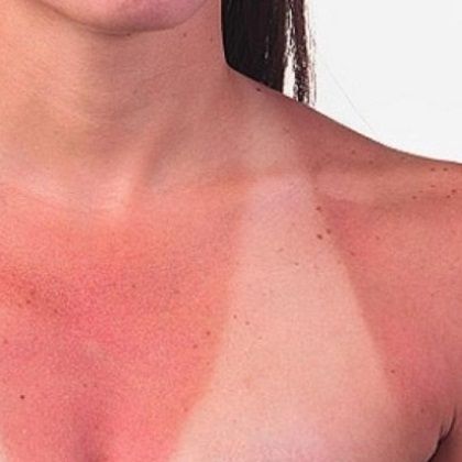 Protecting your skin with sun blocking clothing