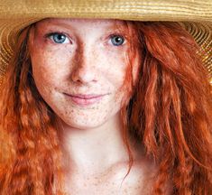 Red Headed girl to explain the kind of skin and hair being discussed.